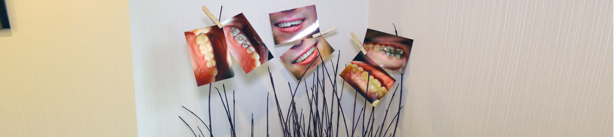 Photo wall of different cosmetic dental successes