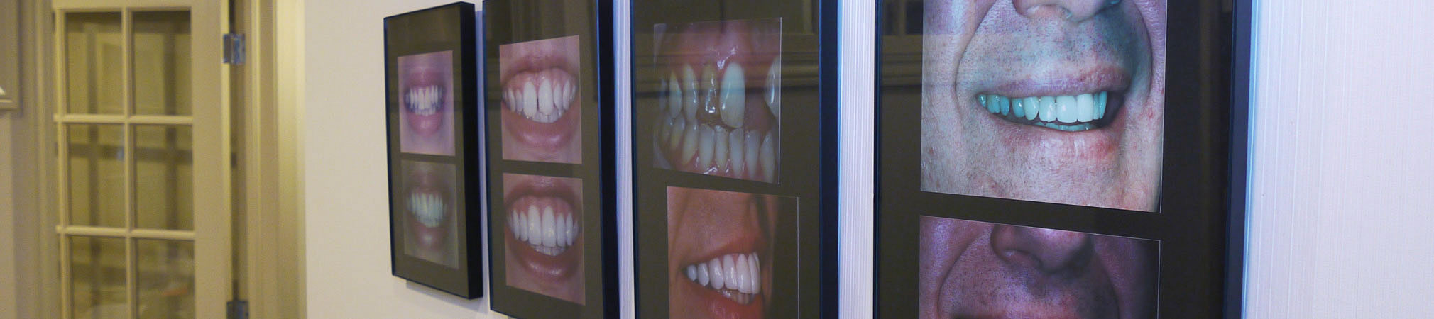 Photo wall of cosmetic dentistry successes 