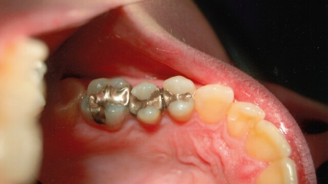 Before photo of a successful cosmetic dentistry procedure
