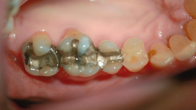 Before photo of a successful cosmetic dentistry procedure